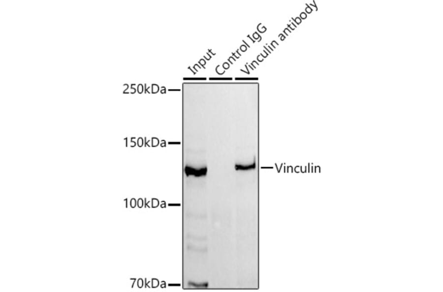 Western Blot - Anti-Vinculin Antibody [ARC51900] (A305534) - Antibodies.com