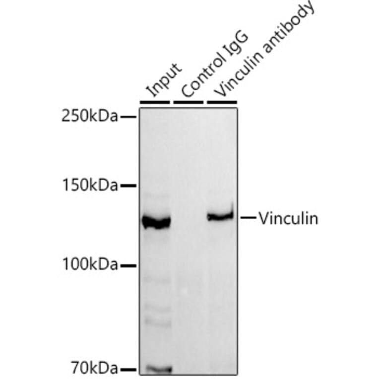 Western Blot - Anti-Vinculin Antibody [ARC51900] (A305534) - Antibodies.com
