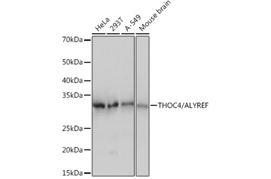 Western Blot - Anti-Aly/Ref Antibody [ARC0959] (A305535) - Antibodies.com