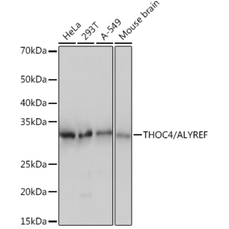 Western Blot - Anti-Aly/Ref Antibody [ARC0959] (A305535) - Antibodies.com