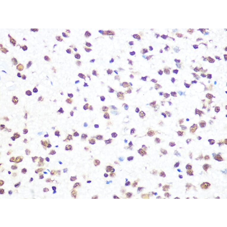 Immunohistochemistry - Anti-Aly/Ref Antibody [ARC0959] (A305535) - Antibodies.com
