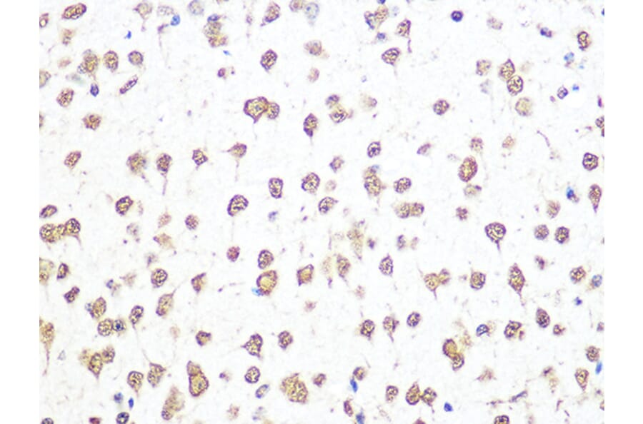 Immunohistochemistry - Anti-Aly/Ref Antibody [ARC0959] (A305535) - Antibodies.com