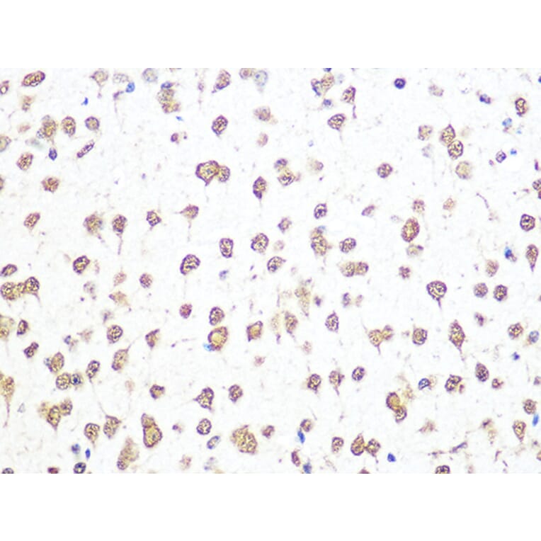 Immunohistochemistry - Anti-Aly/Ref Antibody [ARC0959] (A305535) - Antibodies.com