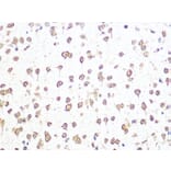 Immunohistochemistry - Anti-Aly/Ref Antibody [ARC0959] (A305535) - Antibodies.com