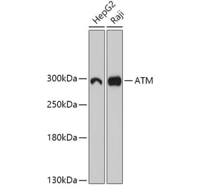 Western Blot - Anti-ATM Antibody (A305537) - Antibodies.com