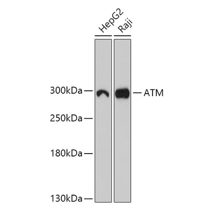 Western Blot - Anti-ATM Antibody (A305537) - Antibodies.com