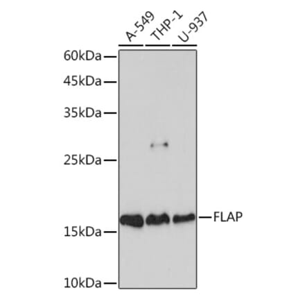 Western Blot - Anti-FLAP Antibody [ARC2204] (A305539) - Antibodies.com