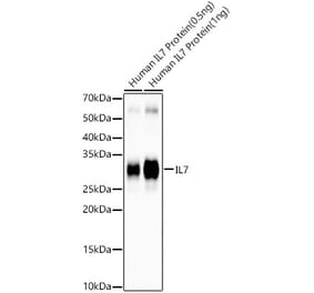 Western Blot - Anti-IL-7 Antibody [ARC57489] (A305541) - Antibodies.com