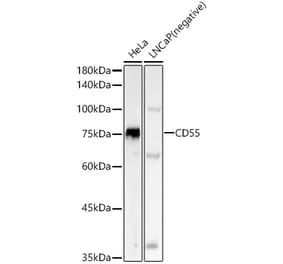 Western Blot - Anti-CD55 Antibody [ARC52244] (A305543) - Antibodies.com