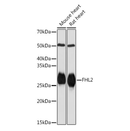 Western Blot - Anti-FHL2 Antibody [ARC2068] (A305544) - Antibodies.com