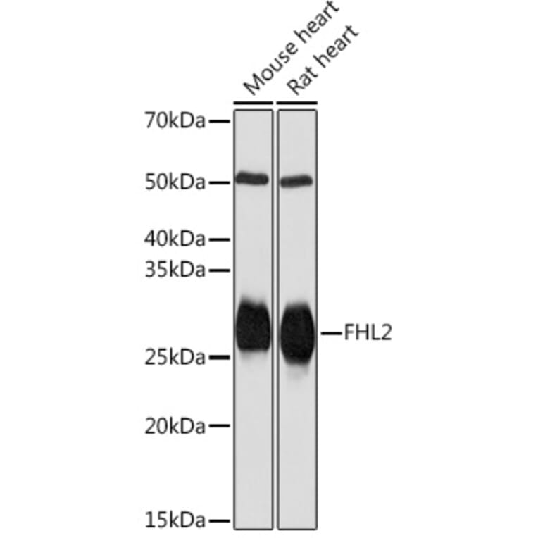 Western Blot - Anti-FHL2 Antibody [ARC2068] (A305544) - Antibodies.com