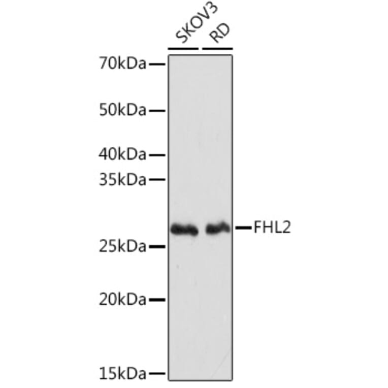 Western Blot - Anti-FHL2 Antibody [ARC2068] (A305544) - Antibodies.com
