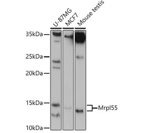 Western Blot - Anti-MRPL55 Antibody (A305545) - Antibodies.com