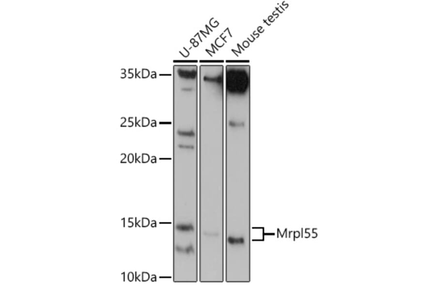 Western Blot - Anti-MRPL55 Antibody (A305545) - Antibodies.com