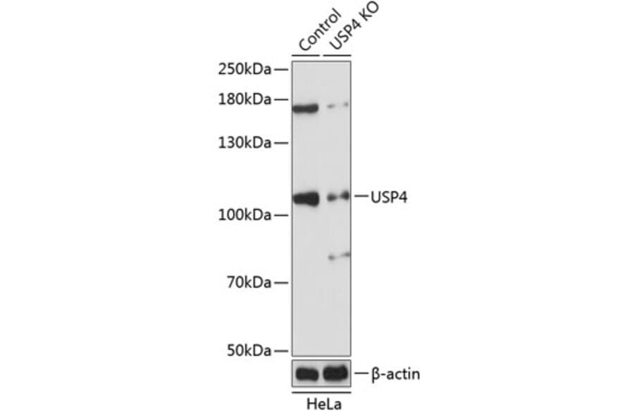 Western Blot - Anti-USP4 Antibody (A305547) - Antibodies.com