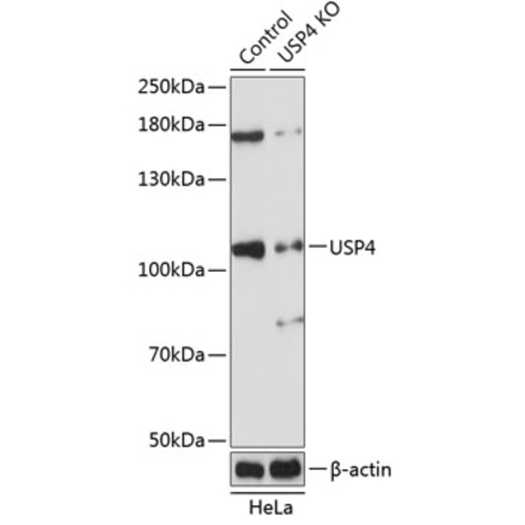 Western Blot - Anti-USP4 Antibody (A305547) - Antibodies.com