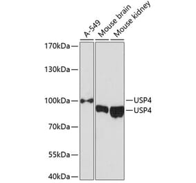 Western Blot - Anti-USP4 Antibody (A305548) - Antibodies.com