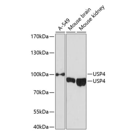 Western Blot - Anti-USP4 Antibody (A305548) - Antibodies.com