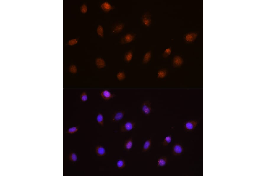 Immunofluorescence - Anti-USP4 Antibody (A305548) - Antibodies.com