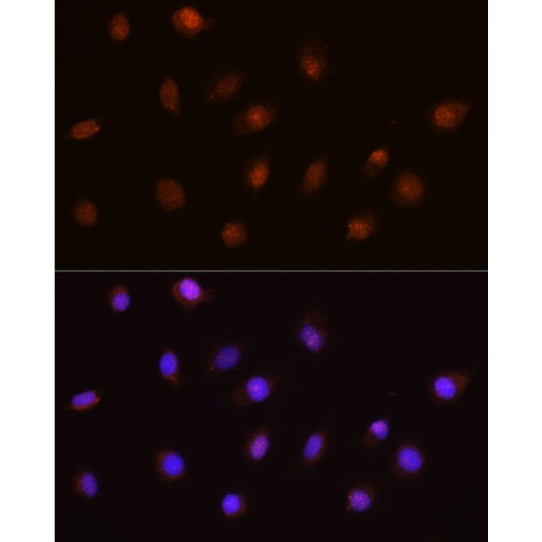 Immunofluorescence - Anti-USP4 Antibody (A305548) - Antibodies.com