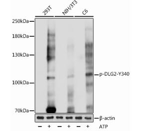 Western Blot - Anti-PSD93 (phospho Tyr340) Antibody (A305549) - Antibodies.com