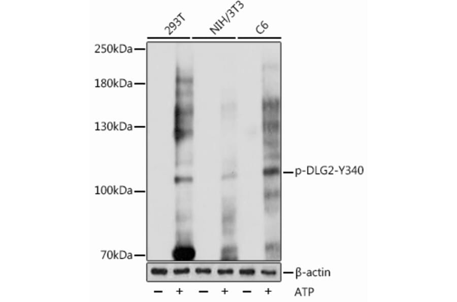 Western Blot - Anti-PSD93 (phospho Tyr340) Antibody (A305549) - Antibodies.com