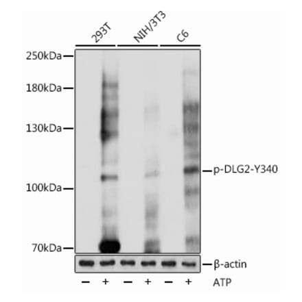 Western Blot - Anti-PSD93 (phospho Tyr340) Antibody (A305549) - Antibodies.com