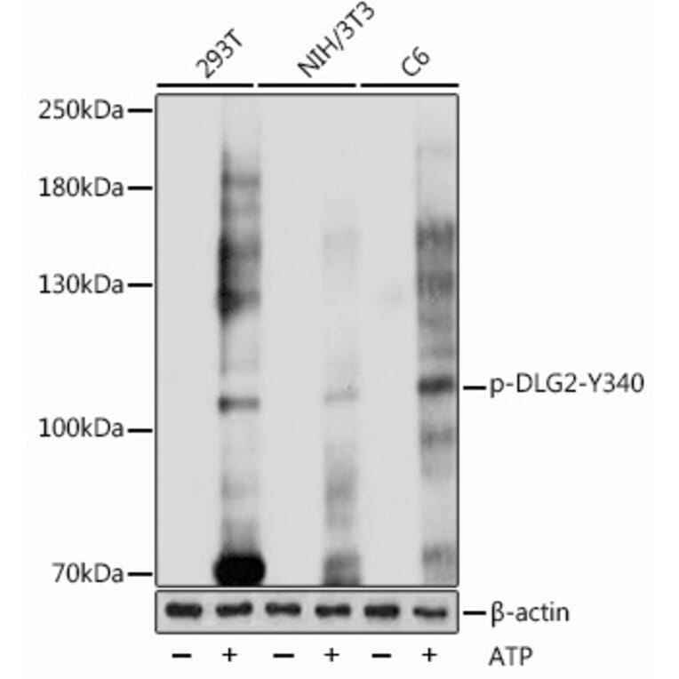Western Blot - Anti-PSD93 (phospho Tyr340) Antibody (A305549) - Antibodies.com