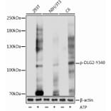 Western Blot - Anti-PSD93 (phospho Tyr340) Antibody (A305549) - Antibodies.com