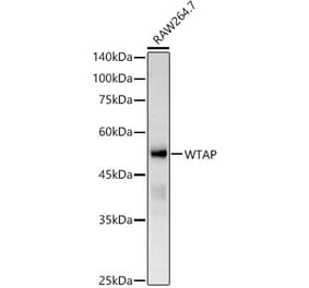 Western Blot - Anti-WTAP Antibody (A305551) - Antibodies.com