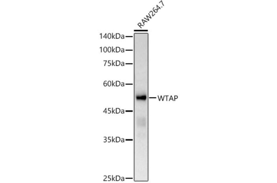 Western Blot - Anti-WTAP Antibody (A305551) - Antibodies.com