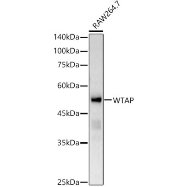Western Blot - Anti-WTAP Antibody (A305551) - Antibodies.com
