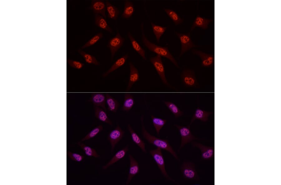 Immunofluorescence - Anti-WTAP Antibody (A305551) - Antibodies.com