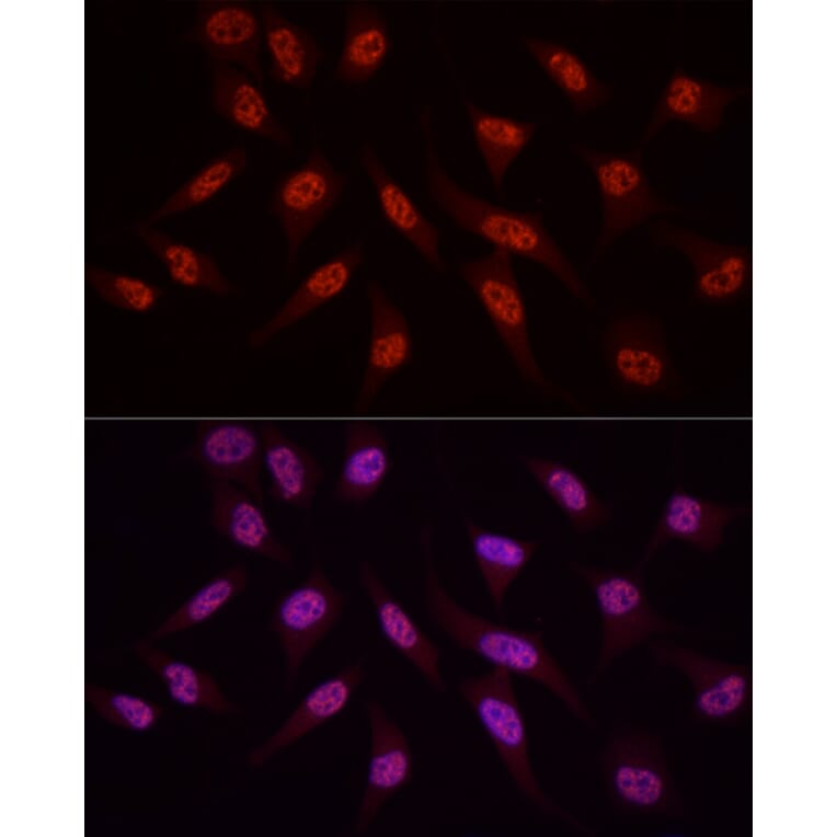 Immunofluorescence - Anti-WTAP Antibody (A305551) - Antibodies.com