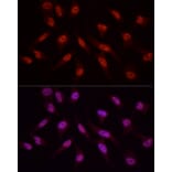 Immunofluorescence - Anti-WTAP Antibody (A305551) - Antibodies.com