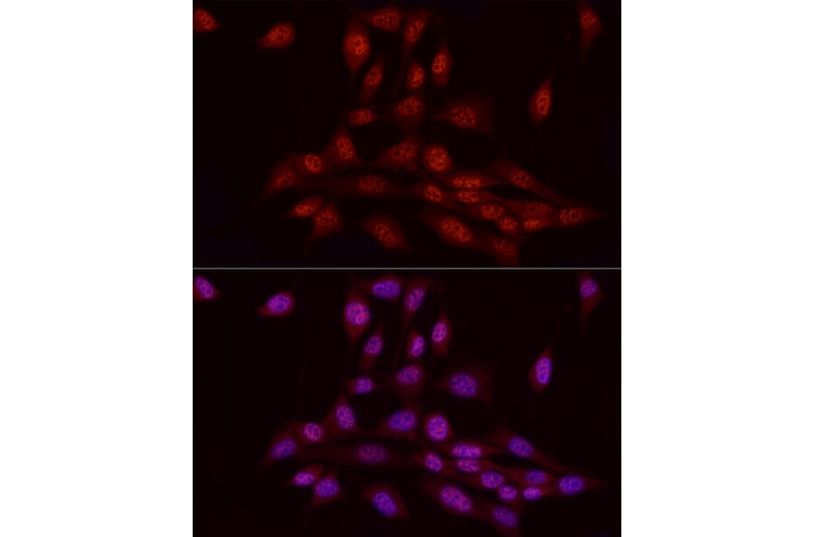 Immunofluorescence - Anti-WTAP Antibody (A305551) - Antibodies.com