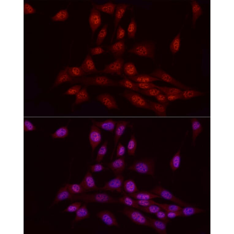 Immunofluorescence - Anti-WTAP Antibody (A305551) - Antibodies.com