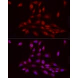 Immunofluorescence - Anti-WTAP Antibody (A305551) - Antibodies.com