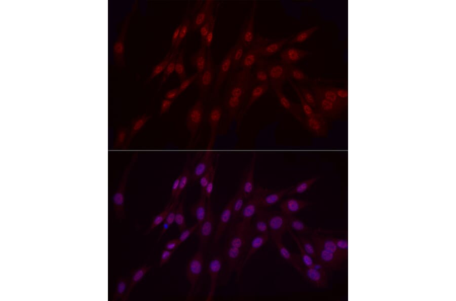 Immunofluorescence - Anti-WTAP Antibody (A305551) - Antibodies.com