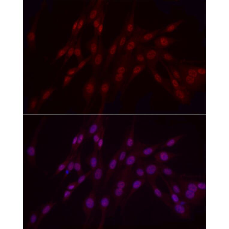 Immunofluorescence - Anti-WTAP Antibody (A305551) - Antibodies.com