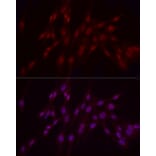Immunofluorescence - Anti-WTAP Antibody (A305551) - Antibodies.com