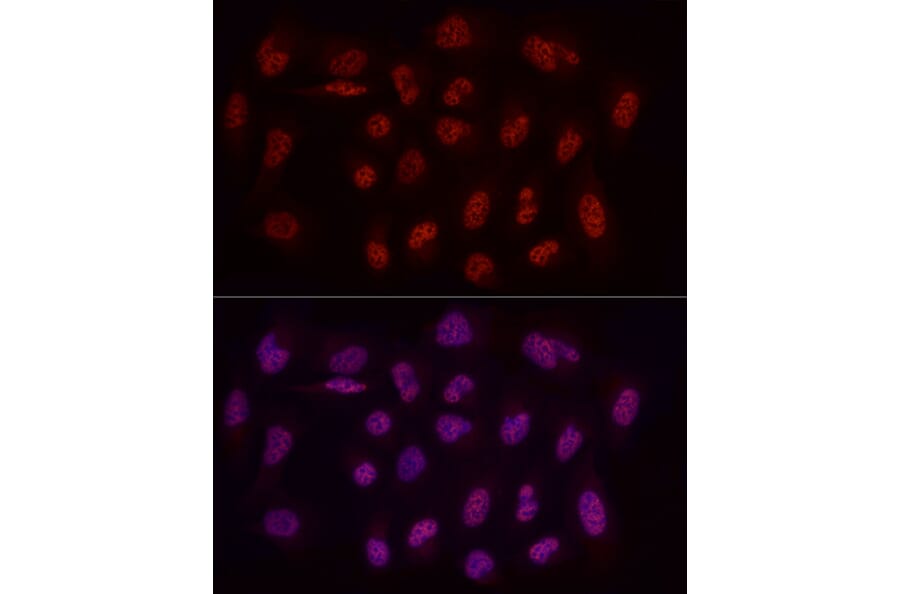Immunofluorescence - Anti-WTAP Antibody (A305551) - Antibodies.com