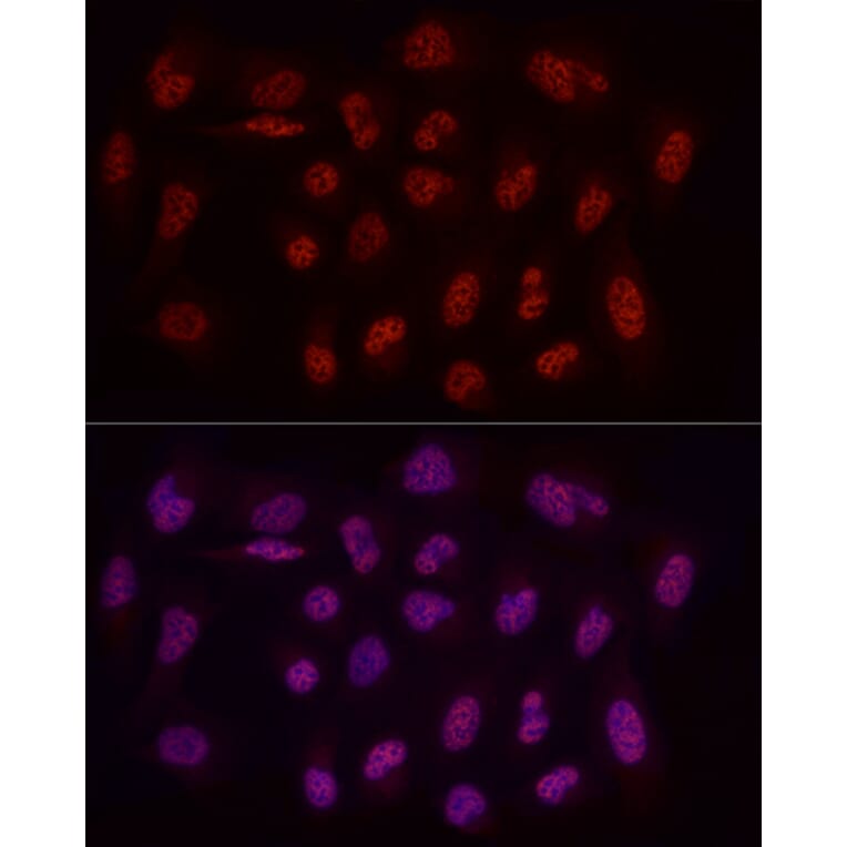 Immunofluorescence - Anti-WTAP Antibody (A305551) - Antibodies.com