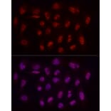 Immunofluorescence - Anti-WTAP Antibody (A305551) - Antibodies.com