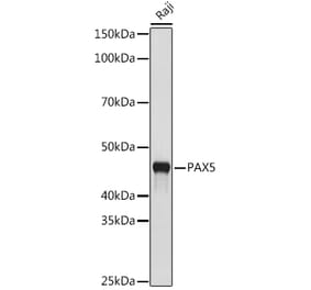 Western Blot - Anti-PAX5 Antibody [ARC1654] (A305552) - Antibodies.com