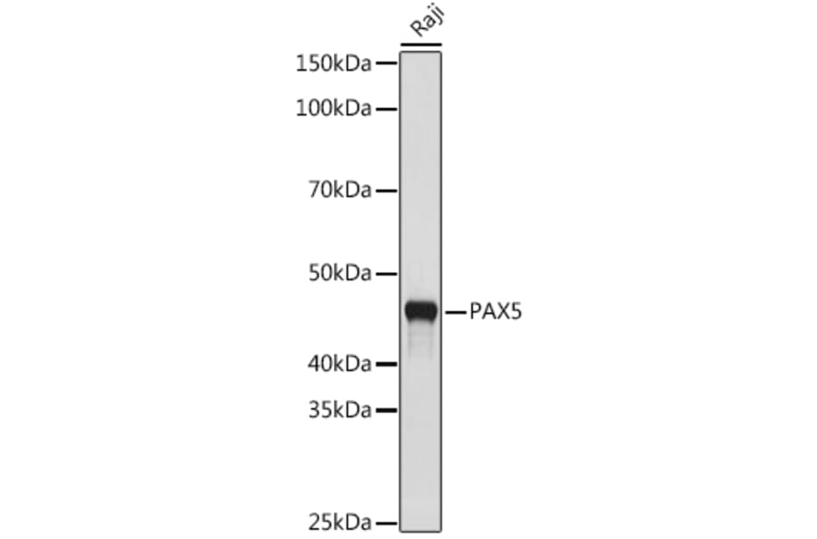 Western Blot - Anti-PAX5 Antibody [ARC1654] (A305552) - Antibodies.com