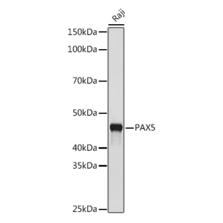 Western Blot - Anti-PAX5 Antibody [ARC1654] (A305552) - Antibodies.com