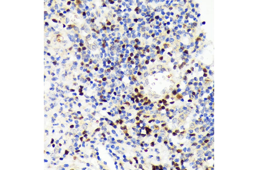 Immunohistochemistry - Anti-PAX5 Antibody [ARC1654] (A305552) - Antibodies.com