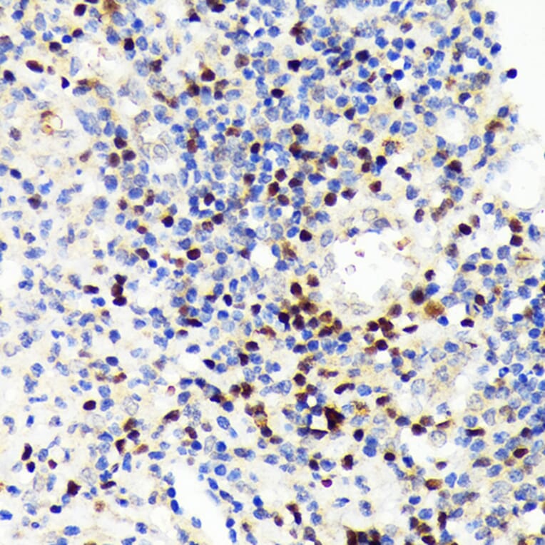 Immunohistochemistry - Anti-PAX5 Antibody [ARC1654] (A305552) - Antibodies.com