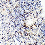 Immunohistochemistry - Anti-PAX5 Antibody [ARC1654] (A305552) - Antibodies.com